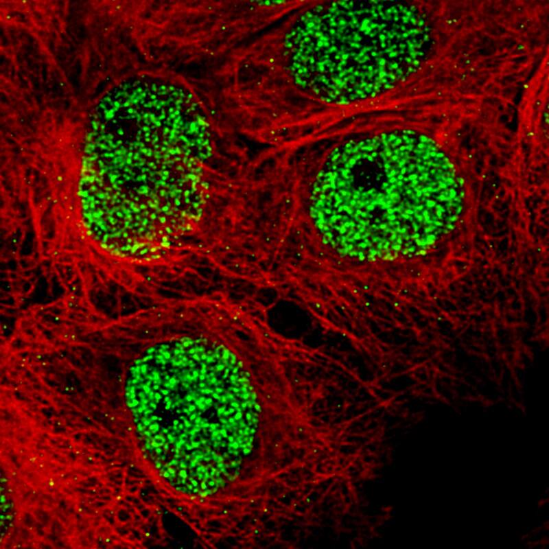 Staining of A-431 cells, showing specific staining in the nucleoplasm in green. Microtubule- and nuclear probes are visualized in red and blue, respectively (where available).