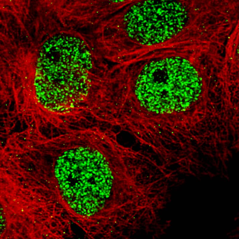 Staining of U-2 OS cells, showing specific staining in the nucleoplasm in green. Microtubule- and nuclear probes are visualized in red and blue, respectively (where available).