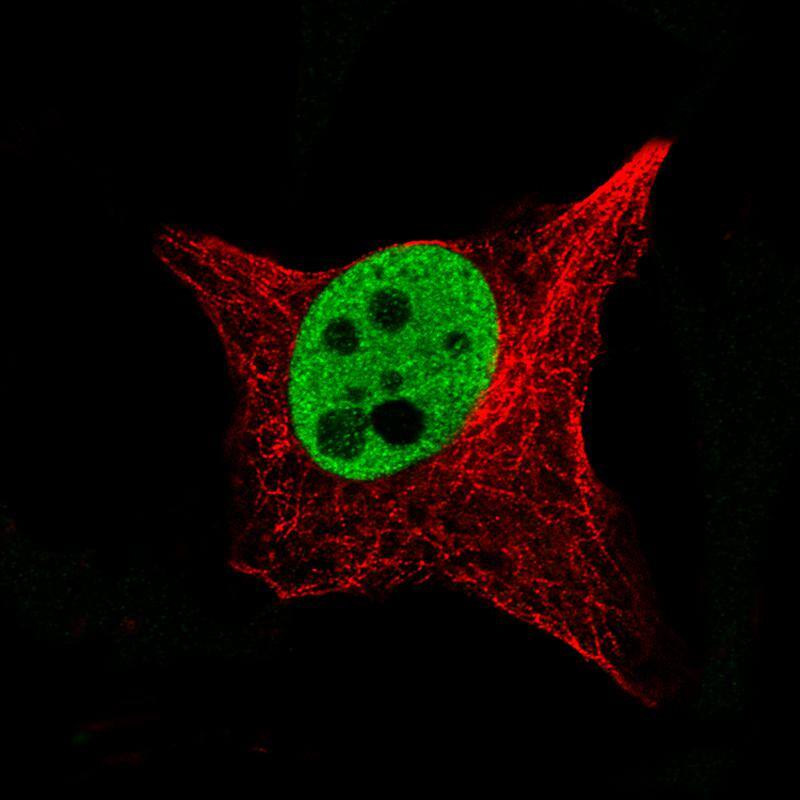 Staining of SK-MEL-30 cells, showing specific staining in the nucleoplasm in green. Microtubule- and nuclear probes are visualized in red and blue, respectively (where available).