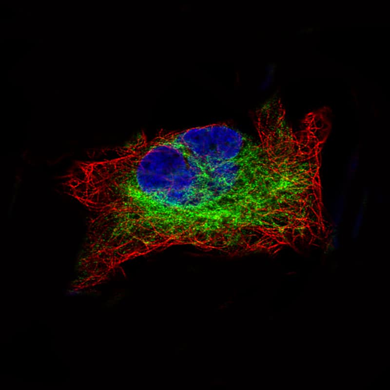 Staining of RH-30 cells, showing specific staining in intermediate filaments in green. Microtubule- and nuclear probes are visualized in red and blue, respectively (where available).