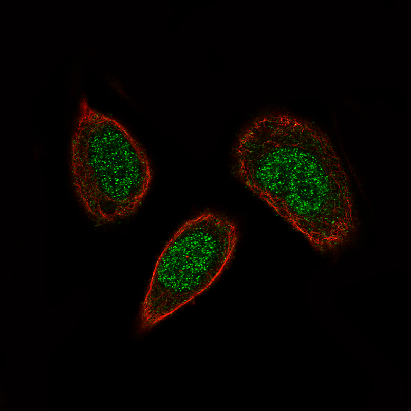 Staining of PC-3 cells, showing specific staining in the nucleus in green. Microtubule- and nuclear probes are visualized in red and blue, respectively (where available).