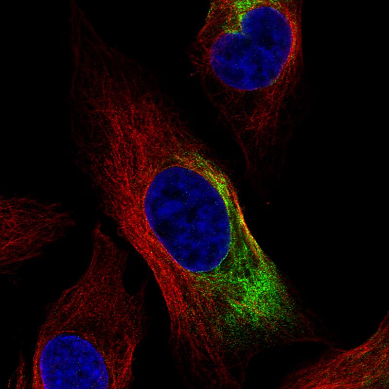 Staining of PC-3 cells, showing specific staining in intermediate filaments in green. Microtubule- and nuclear probes are visualized in red and blue, respectively (where available).