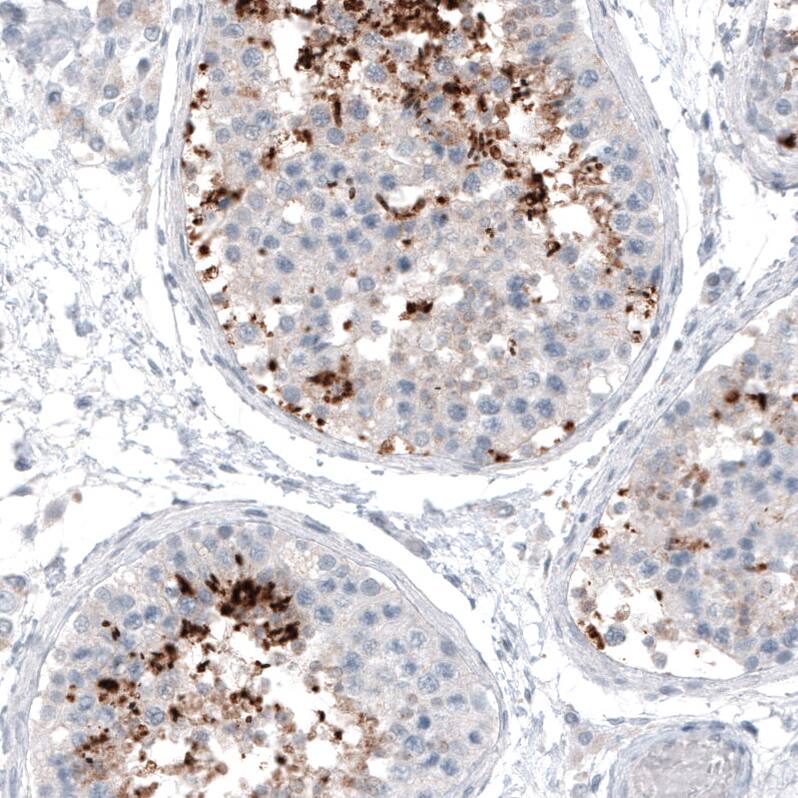 Staining of human testis shows moderate to strong cytoplasmic positivity in a subset of cells in seminiferous ducts.