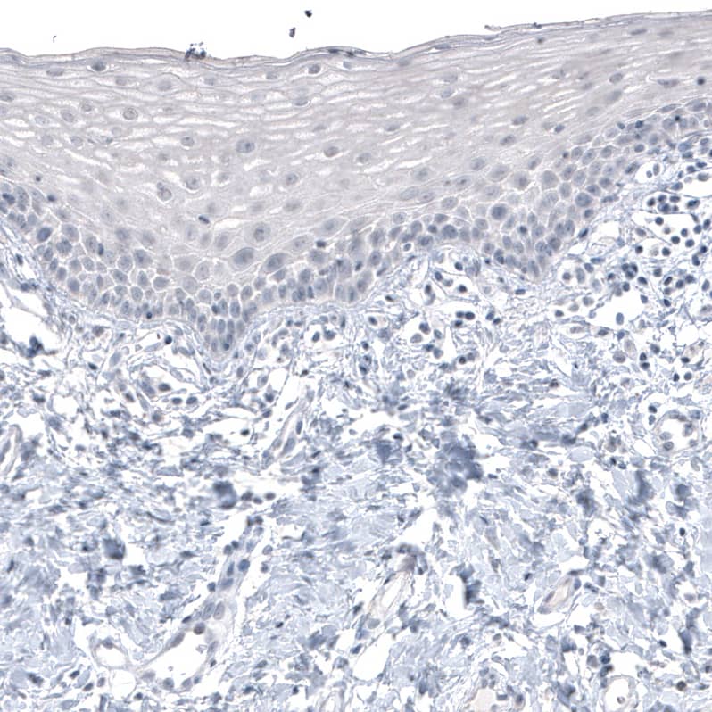 Staining of human uterine cervix shows no positivity in squamous epithelial cells as expected.