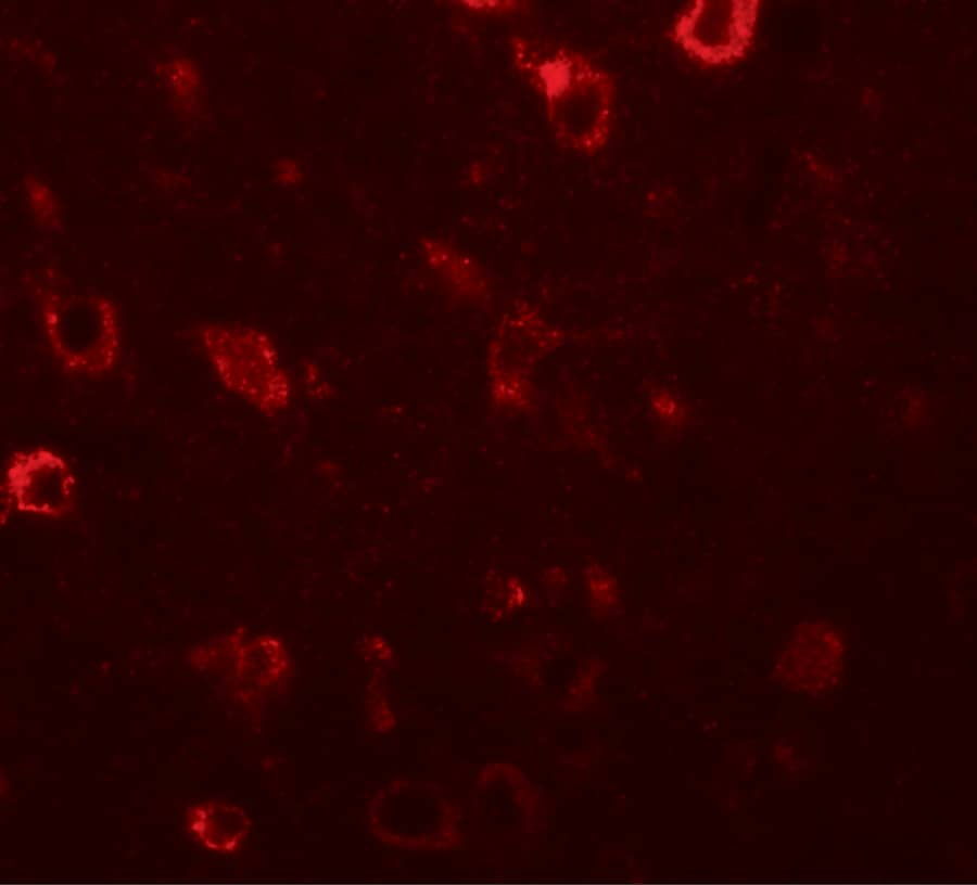 Immunocytochemistry/ Immunofluorescence CIITA Antibody - BSA Free