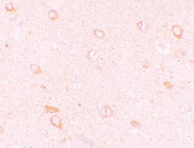 Immunohistochemistry CIITA Antibody - BSA Free