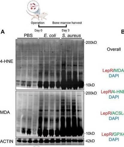 S. aureus and E. coli infections induced lipid peroxides accumulation in infected bone microenvironment and BMSCs. A) Lipid peroxidation levels in bone marrow on Day 3 post‐infection in murine osteomyelitis model induced by S. aureus and E. coli were determined by WB analysis of 4‐HNE and MDA protein modifications. Each group contained four mice. B) Representative tissue immunofluorescence images of LepR, MDA, 4‐HNE, ACSL4, GPX4 in the uninfected murine femur and implant‐associated bone infection model induced by S. aureus and E. coli. Scale bar = 50 um. C) The schematic route of animal experiments and gating strategy were depicted. D) Lipid peroxide regulation by S. aureus and E. coli infections and Fer‐1 in CD45−CD31−Ter119−LepR+ BMSCs were analyzed in murine osteomyelitis model by Liperfluo staining and analyzed by flow cytometry. E,F) Quantification of median fluorescent intensity in flow cytometry analysis in (D). Values are means +/- SDs. Each group contained six mice. Multiple comparison was performed by one‐way analysis of variance (ANOVA) with Tukey's post‐hoc analysis. Image collected and cropped by CiteAb from the following open publication (//pubmed.ncbi.nlm.nih.gov/39166412), licensed under a CC-BY license. Not internally tested by Novus Biologicals.