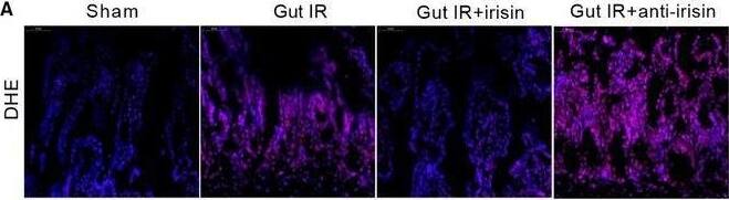 Irisin decreases the oxidative stress, calcium influx and ER stress after gut IR. Irisin (250 μg/kg in 0.5 mL saline, a single dose, iv) was administered immediately after reperfusion. Anti‐irisin (4 mg/kg, Abcam, USA) blocking antibody was administered at 24 h before gut IR. Four hours after reperfusion, mice were sacrificed, and tissue samples were collected. A,B, DHE fluorescence staining of gut tissues; (C‐G) levels of gut malonaldehyde (MDA), xanthine oxidase (XO), 4‐hydroxynonenal (4‐HNT), superoxide dismutase (SOD) and glutathione peroxidase activity (GSH‐PX), respectively; n = 6 per group, mean +/- SEM, *P < .05 vs the sham group, #P < .05 vs the gut IR group. Caco‐2 cells were exposed to hypoxia for 90 min, and 10 nmol/L irisin was added at the beginning of reoxygenation. (H,I) DHE fluorescence staining; (J,K) Fluo‐4 AM staining of Ca2+; (L,M) Western blot analysis of IRE1 and CHOP expression at 4 h after reoxygenation in Caco‐2 cells; n = 3 per group, mean +/- SEM, *P < .05 vs the sham group, #P < .05 vs the H/R group Image collected and cropped by CiteAb from the following open publication (//pubmed.ncbi.nlm.nih.gov/31701659), licensed under a CC-BY license. Not internally tested by Novus Biologicals.