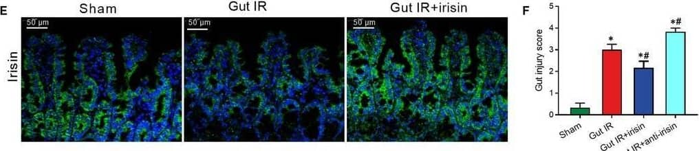 Exogenous irisin restores gut barrier function after gut IR. Irisin (250 μg/kg in 0.5 mL saline, a single dose, iv) was administered immediately after reperfusion. Anti‐irisin (4 mg/kg, Abcam) blocking antibodies were administered at 24 h before gut IR. Four hours after reperfusion, mice were sacrificed, and tissue samples were collected. A, Serum irisin levels; (B,C) Western blot analysis of irisin expression; (D,E) immunofluorescence staining of irisin (green) and the corresponding nuclear counterstaining (blue) in gut tissues; (F) gut injury score; (G) haematoxylin and eosin (H&E) staining; (H) water content of gut; (I) serum FITC‐dextran levels; (J,K) colony‐forming units (CFUs) from mesenteric lymph node (MLN) and lung tissues; (L,M) serum levels of LDH and lactate; and (N,O) serum TNF‐ alpha  and CIRP levels. n = 6 per group, mean +/- SEM, *P < .05 vs the sham group, #P < .05 vs the gut IR group Image collected and cropped by CiteAb from the following open publication (//pubmed.ncbi.nlm.nih.gov/31701659), licensed under a CC-BY license. Not internally tested by Novus Biologicals.