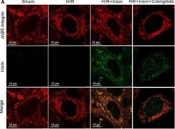 Irisin protects against gut IR injury via binding to integrin  alpha v beta 5 receptor in enterocyte. Caco‐2 cells were exposed to hypoxia for 90 min, and 10 nmol/L irisin and 20 μmol/L cilengitide trifluoroacetate were added at the beginning of reoxygenation. A, Immunofluorescence staining of irisin (green), integrin  alpha V beta 5 (red) and the corresponding nuclear counterstaining (blue) in Caco‐2 cells at 4 h after reoxygenation in Caco‐2 cells. Irisin (250 μg/kg, iv) and cilengitide trifluoroacetate (20 mg/kg, iv) were administered immediately after reperfusion. Four hours after reperfusion, mice were sacrificed, and tissue samples were collected. (B) CO‐IP of irisin and integrin  alpha V beta 5; (C) serum FITC‐dextran levels; (D) colony‐forming units (CFUs) from mesenteric lymph node (MLN) tissues; (E) haematoxylin and eosin (H&E) staining; (F) gut injury score; n = 6 per group, mean +/- SEM, *P < .05 vs the gut IR group, #P < .05 vs the gut IR + irisin group. (G,H) Western blot analysis of claudin‐1 and occludin expression in Caco‐2 cells; and (I,J) immunofluorescence staining of JAM‐1 and ZO‐1 and the corresponding nuclear counterstaining (blue). * in the figure represents intercellular gap. n = 3 per group, mean +/- SEM, *P < .05 vs the sham group, #P < .05 vs the H/R group Image collected and cropped by CiteAb from the following open publication (//pubmed.ncbi.nlm.nih.gov/31701659), licensed under a CC-BY license. Not internally tested by Novus Biologicals.