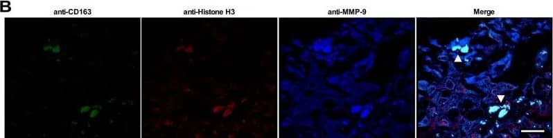 Identification of MET-like structures within human fetal membrane tissues infected with GBS ex vivo. Fetal membrane tissues were excised from healthy, term placental tissues from women undergoing routine cesarean section. (A and B) Fetal membrane tissues were then infected with GBS on the choriodecidual surface for 48 h prior to fixation and immunohistochemistry (A) or confocal microscopy (B). (A) Fetal membrane tissues were stained with hematoxylin and eosin (H & E), and representative images are shown at a magnification of ×4. The area within the red box is shown in sections stained with anti-GBS, anti-CD163, or anti-histone H3 antibodies and visualized by immunohistochemistry. GBS cells are able to invade from the choriodecidual surface (CD) toward the amnion epithelium (AE). Macrophages are shown in the area of GBS infection, and macrophages with extracellular histone staining (rightmost image, insert with ×40 magnification) are demonstrated in an area that is also stained with the macrophage marker CD163 (red boxes). Bars represent 100 μm. (B) Fixed and paraffin-embedded fetal membranes were stained with conjugated primary antibodies against CD163, histone H3, and MMP-9. CD163-positive cells within the membrane tissue are seen extruding contents that stain positive for histones and MMP-9 consistent with METs (white arrowheads). Bars represent 20 μm. Image collected and cropped by CiteAb from the following open publication (//pubmed.ncbi.nlm.nih.gov/30459195), licensed under a CC-BY license. Not internally tested by Novus Biologicals.