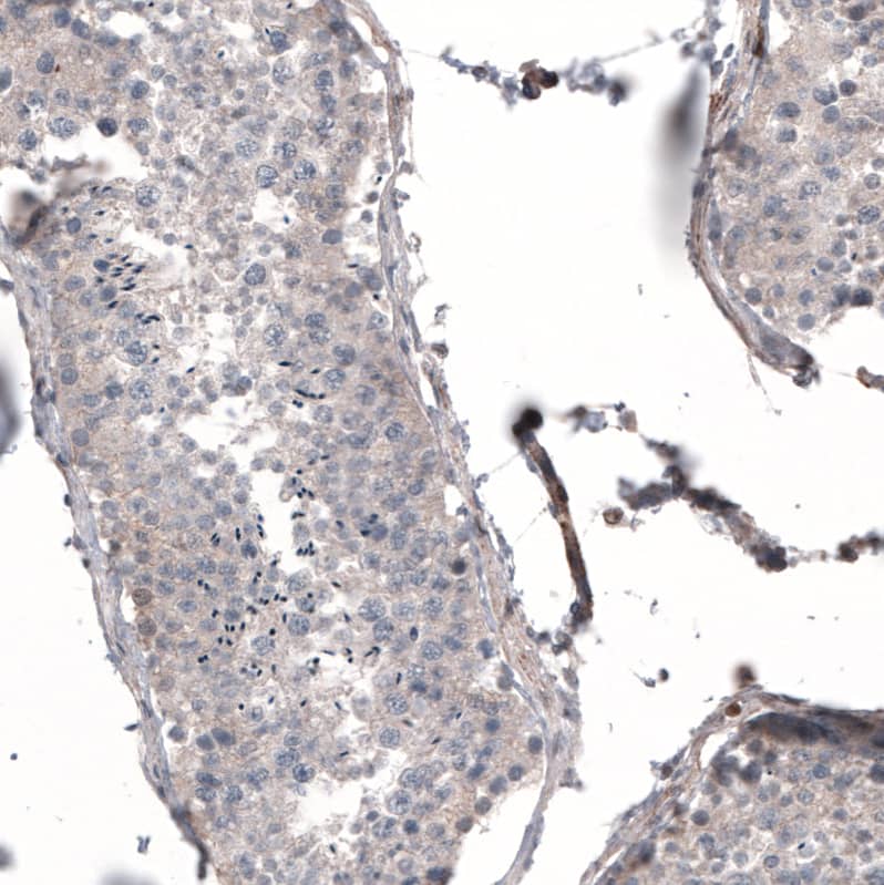 Staining of human testis shows very weak cytoplasmic positivity in cells in seminiferous ducts.