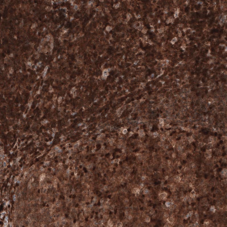 Staining of human tonsil shows strong cytoplasmic positivity in germinal and non-germinal center cells.
