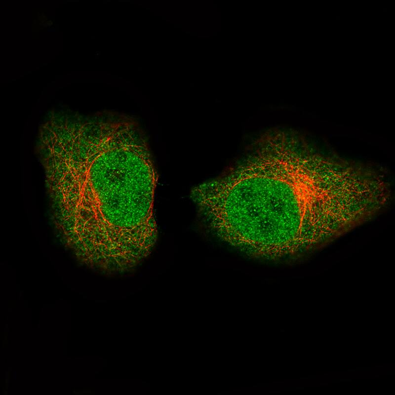 Staining of A549 cells, showing specific staining in the nucleoplasm and cytosol in green. Microtubule- and nuclear probes are visualized in red and blue, respectively (where available).