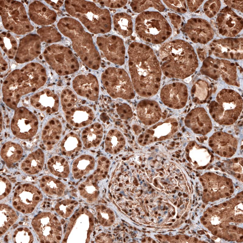 Staining of human kidney shows strong cytoplasmic and nuclear positivity in cells in tubules.