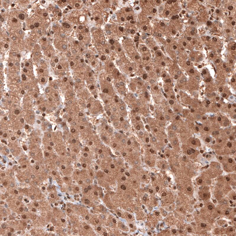 Staining of human liver shows moderate to strong cytoplasmic and nuclear positivity in hepatocytes.