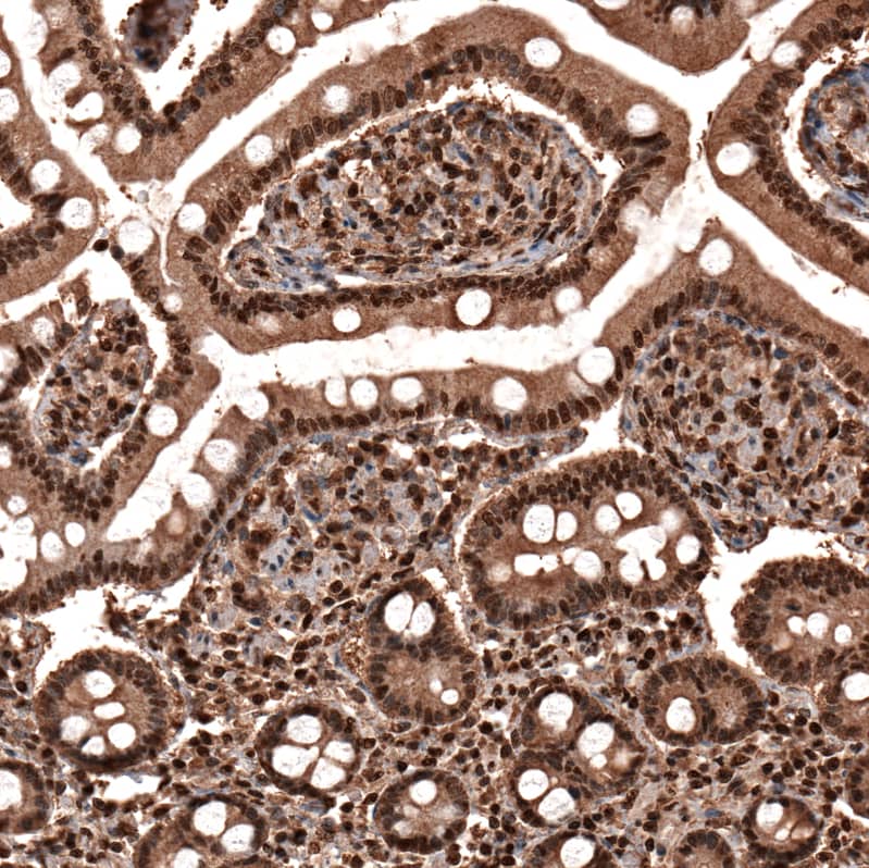 Staining of human duodenum shows strong cytoplasmic and nuclear positivity in glandular cells.