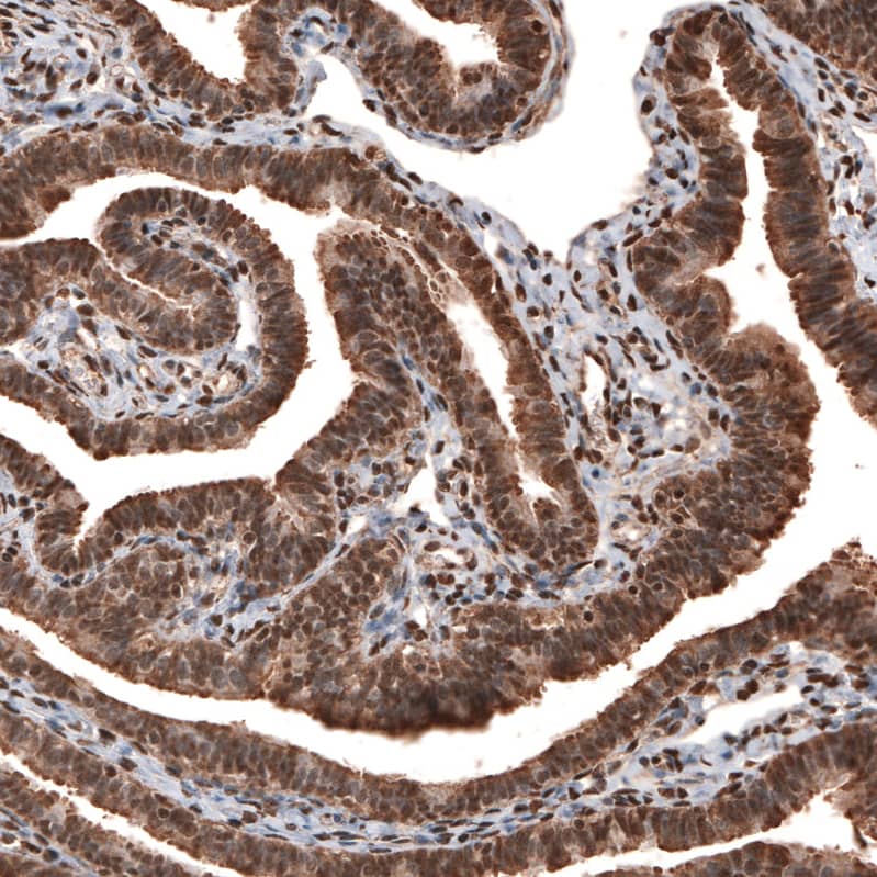 Staining of human fallopian tube shows strong cytoplasmic and nuclear positivity in glandular cells.