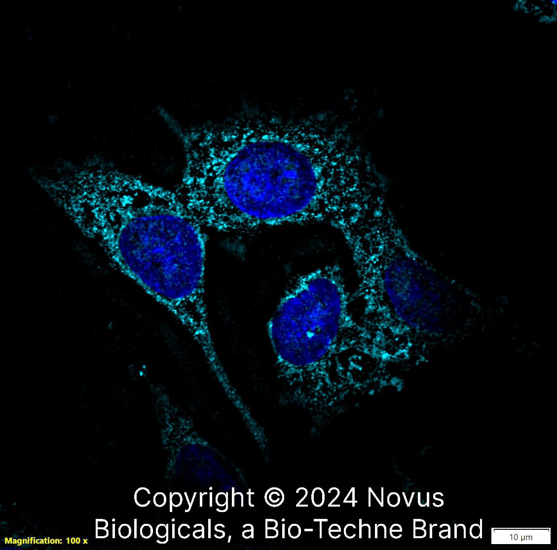 Lysozyme was detected in immersion fixed HepG2 human hepatocellular carcinoma cell line using Rabbit anti-Lysozyme Affinity Purified Polyclonal Antibody conjugated to DyLight 650 (Catalog # NBP2-61118C) (light blue) at 10 µg/mL overnight at 4C. Cells were counterstained with DAPI (dark blue). Cells were imaged using a 100X objective and digitally deconvolved.