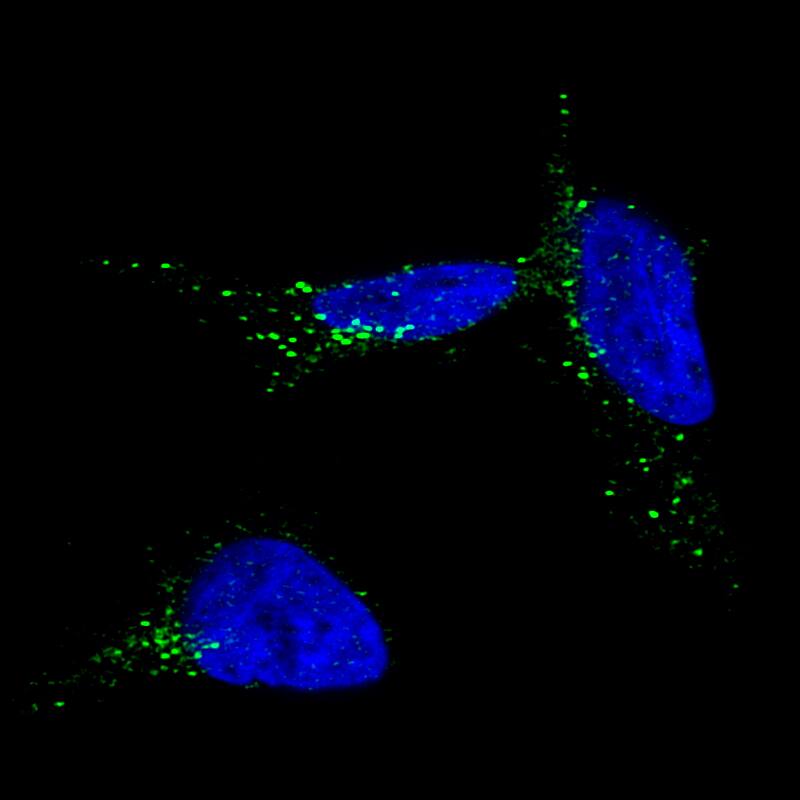 Staining of SK-MEL-30 cells, showing specific staining in the vesicles in green. Microtubule- and nuclear probes are visualized in red and blue, respectively (where available).