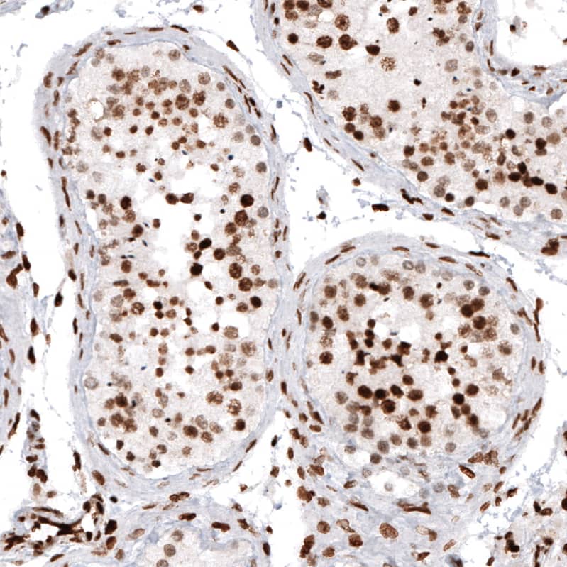 Staining of human testis shows moderate to strong nuclear positivity in cells in seminiferous ducts.
