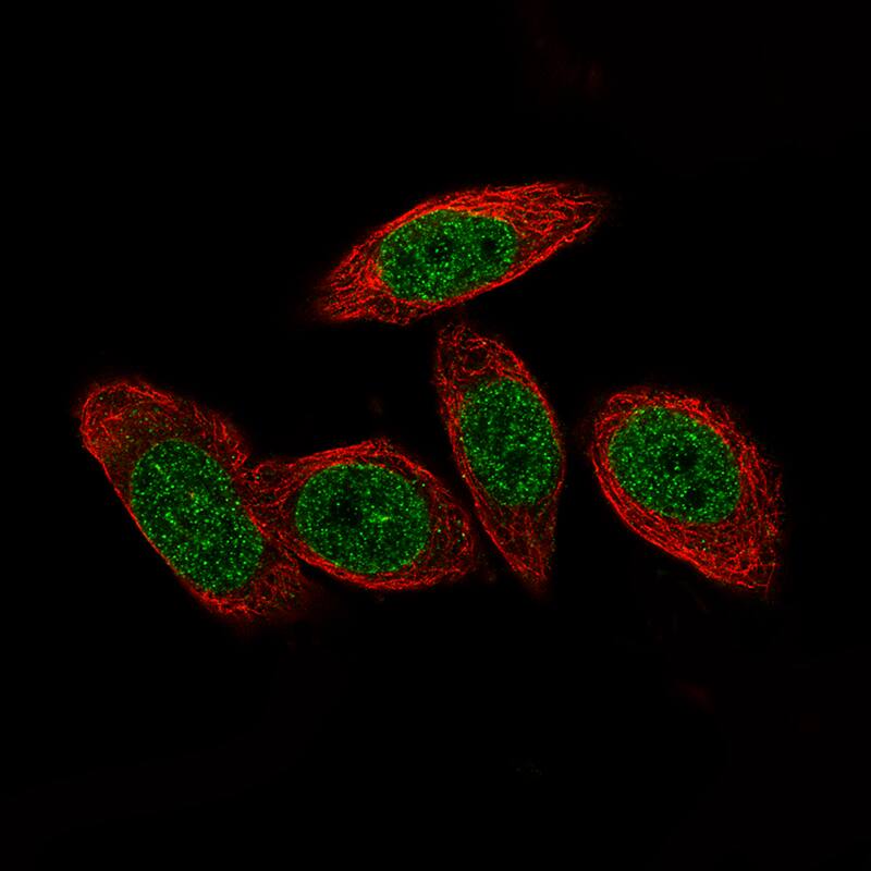 Staining of PC-3 cells, showing specific staining in the nucleoplasm and nuclear membrane in green. Microtubule- and nuclear probes are visualized in red and blue, respectively (where available).