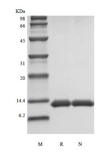 SDS-PAGE Recombinant Human Serum Amyloid A Protein