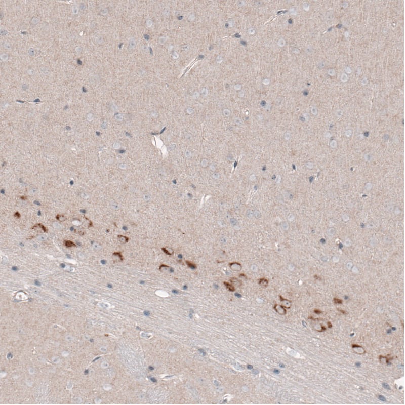 Staining of mouse cerebral cortex shows strong cytoplasmic positivity in layer 6b neurons.