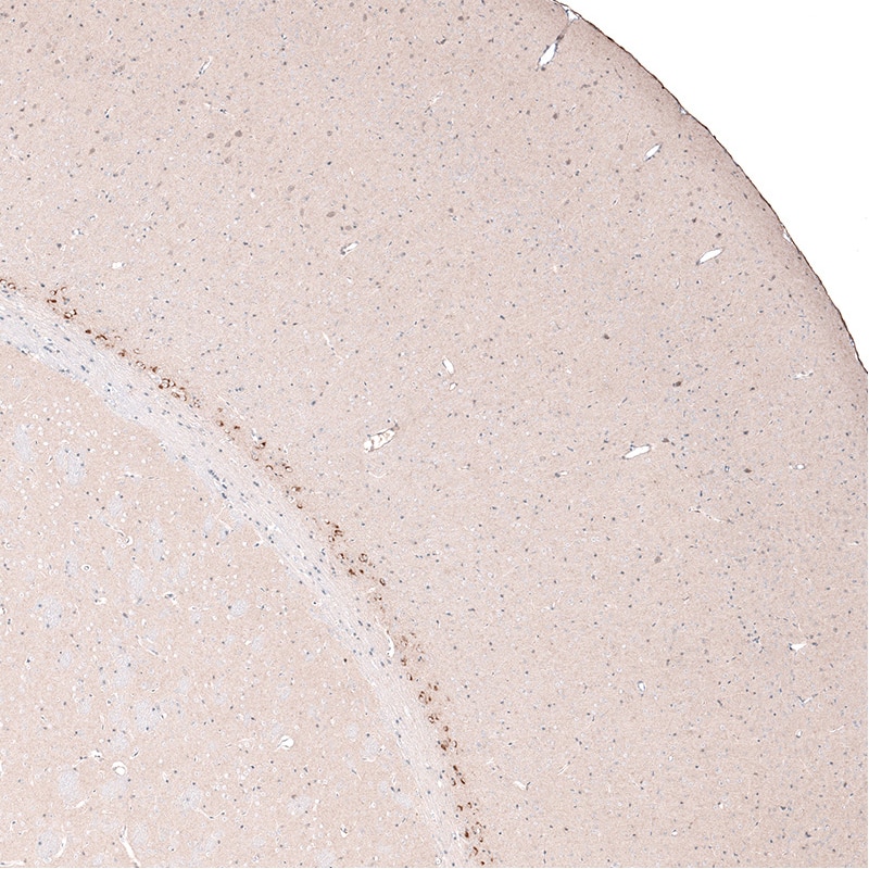 Staining of mouse cerebral cortex shows strong cytoplasmic positivity in layer 6b neurons.