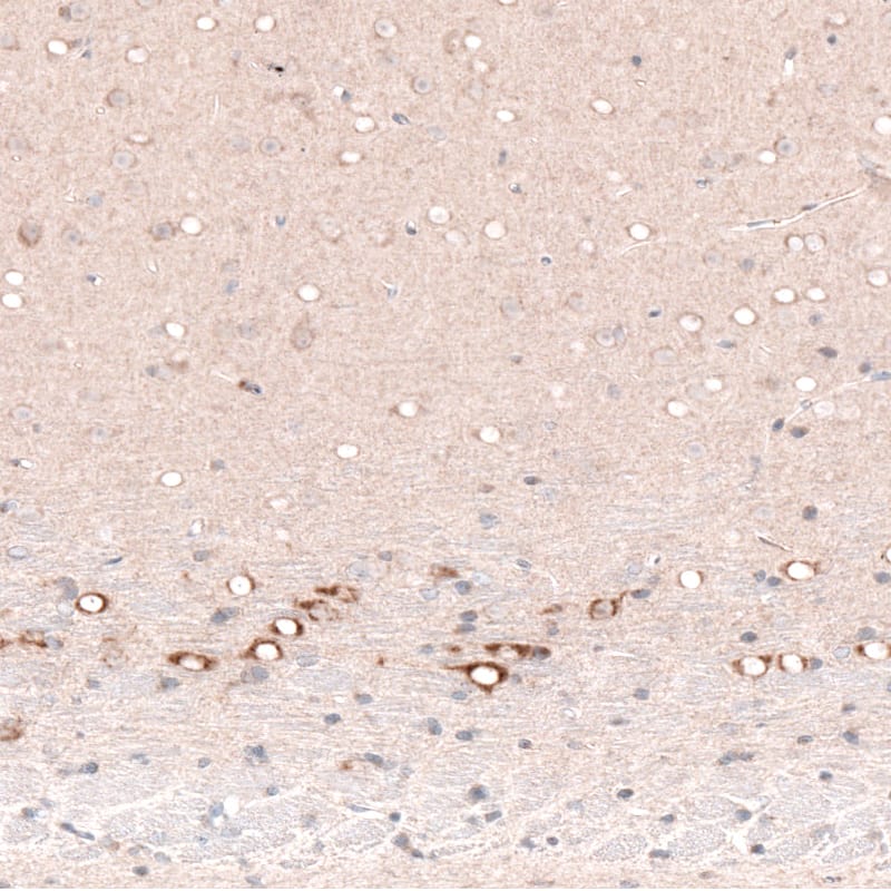 Staining of rat cerebral cortex shows strong cytoplasmic positivity in layer 6b neurons.