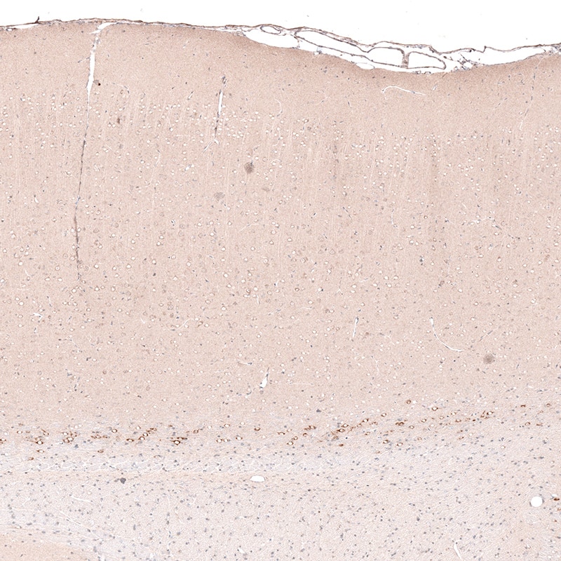 Staining of rat cerebral cortex shows strong cytoplasmic positivity in layer 6b neurons.