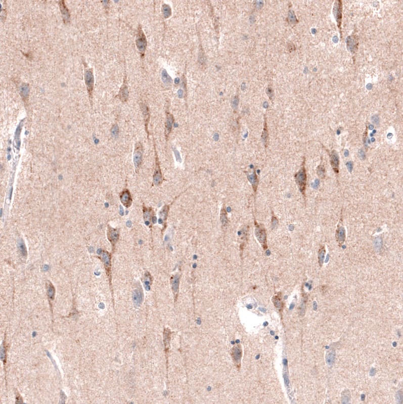 Staining of human cerebral cortex shows strong cytoplasmic positivity in layer 6b neurons.