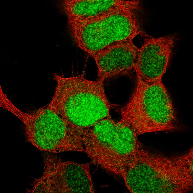 Staining of SH-SY5Y cells, showing specific staining in the nucleoplasm in green. Microtubule- and nuclear probes are visualized in red and blue, respectively (where available).