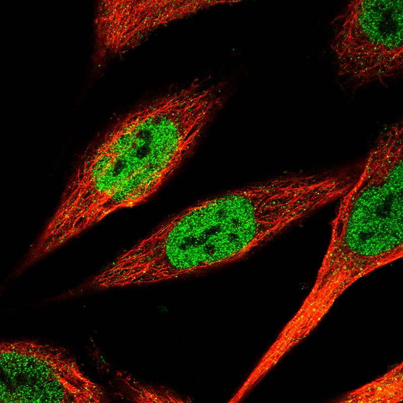 Staining of PC-3 cells, showing specific staining in the nucleoplasm in green. Microtubule- and nuclear probes are visualized in red and blue, respectively (where available).
