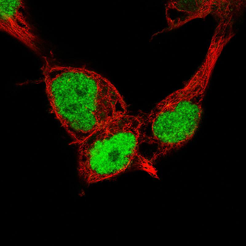 Staining of NTERA-2 cells, showing specific staining in the nucleoplasm in green. Microtubule- and nuclear probes are visualized in red and blue, respectively (where available).