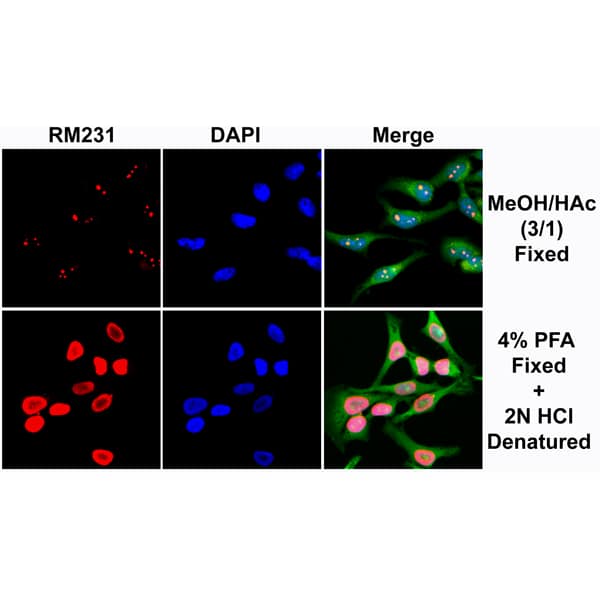 Immunocytochemistry/Immunofluorescence: 5-MethylCytosine Antibody (RM231) [NBP2-61470] - Immunocytochemical staining of HeLa cells using NBP2-61470 (red). Actin filaments have been labeled with fluorescein phalloidin (green), and nuclei stained with DAPI (blue).