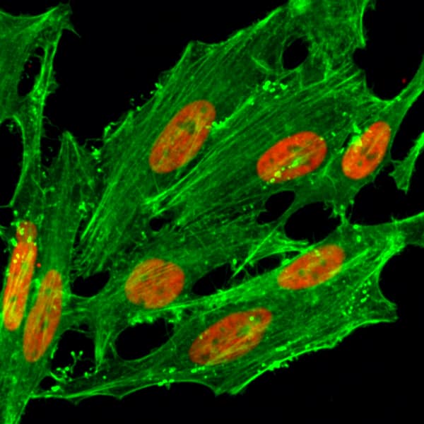 Immunocytochemistry/ Immunofluorescence: Histone H2A.Z [ac Lys7] Antibody (RM222) - Azide and BSA Free [NBP2-61484] - Immunocytochemical staining of HeLa cells treated with sodium butyrate, using Clone RM222 (red). Actin filaments have been labeled with fluorescein phalloidin (green).