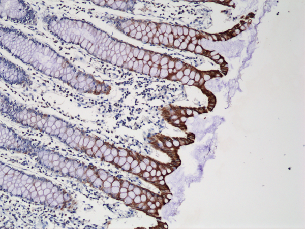 Immunohistochemistry-Paraffin: Cytokeratin 20 Antibody (RM283) [NBP2-61523] - Immunohistochemical staining of formalin fixed and paraffin embedded human colon tissue sections using NBP2-61523 at a 1:250 dilution