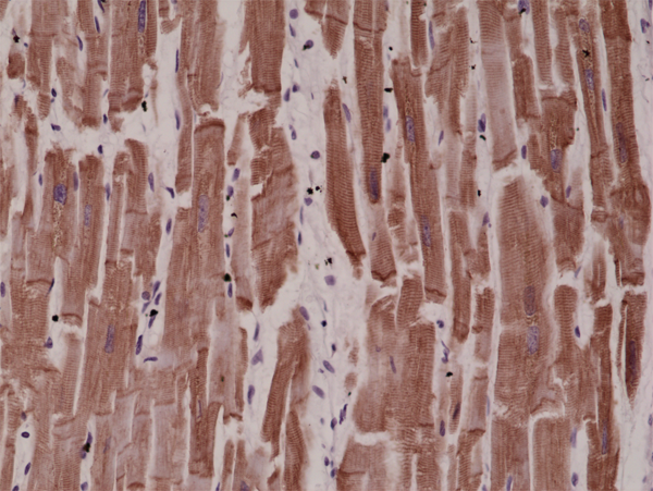 Immunohistochemistry-Paraffin: Desmin Antibody (RM234) [NBP2-61527] - Immunohistochemical staining of formalin fixed and paraffin embedded human heart tissue sections using NBP2-61527 at a 1:4000 dilution
