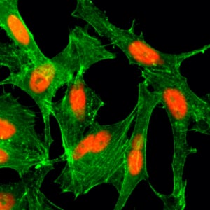 Immunocytochemistry/ Immunofluorescence: Histone H4 [ac Lys12] Antibody (RM202) - Azide and BSA Free [NBP2-61554] - Immunocytochemistry of HeLa cells treated with sodium butyrate, using Clone RM202 (red). Actin filaments have been labeled with fluorescein phalloidin (green).