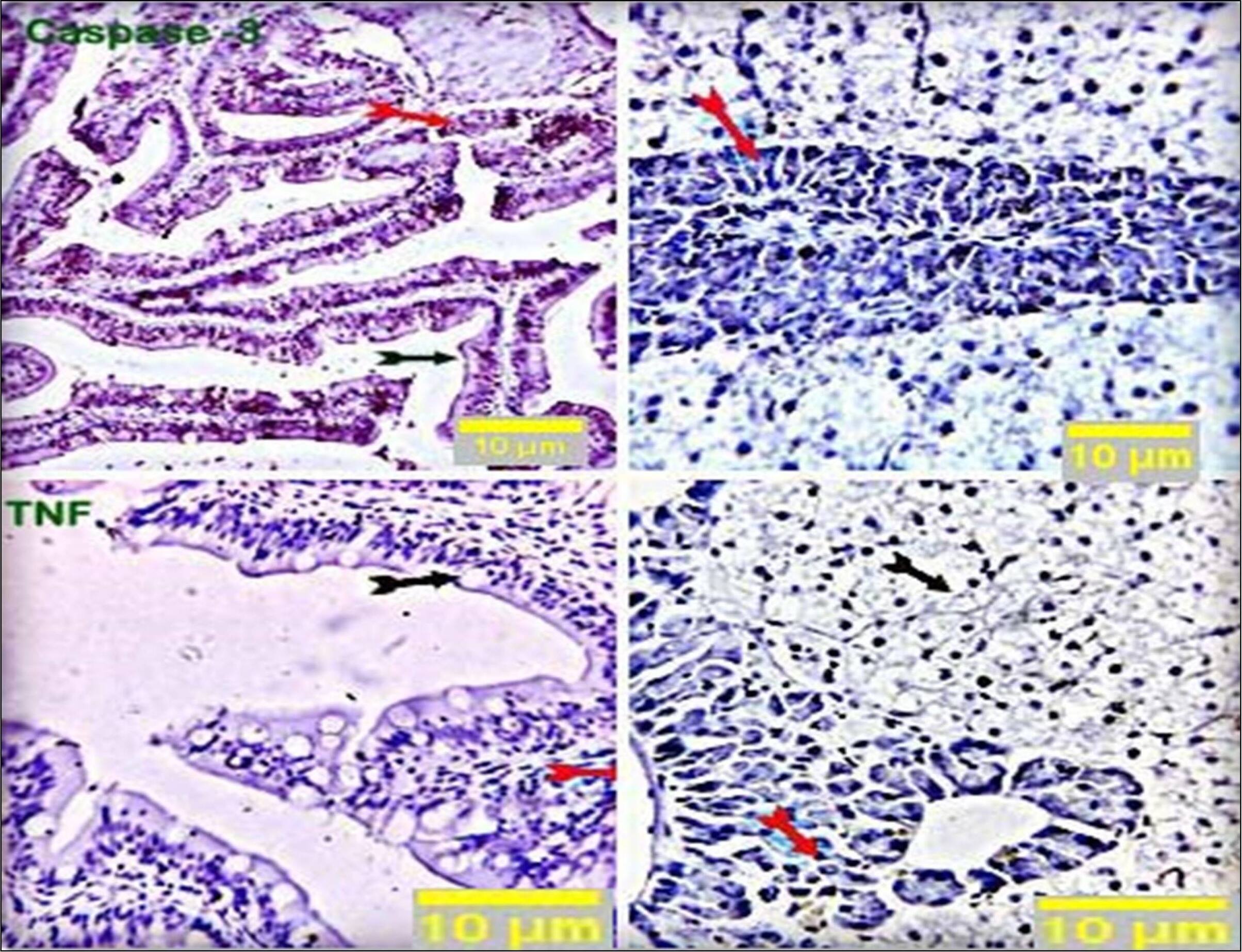 Immunohistochemistry: TNF-alpha Antibody (Z74P2C5*A12) - BSA Free [NBP2-61611] - Stained sections of fish intestine and liver of the control group showed negative staining reactions in all the examined parts of the intestinal and hepatic tissue (black and red arrows) against caspase-3 (NB600-1235) and TNF-alpha (NBP2-61611) antibodies. Nearly 10% of hepatic portal cells reacted positively to caspase-3. Scale bars = 10 um. Image collected and cropped by CiteAb from the following publication (//pubmed.ncbi.nlm.nih.gov/35624801/) licensed under a CC-BY license.