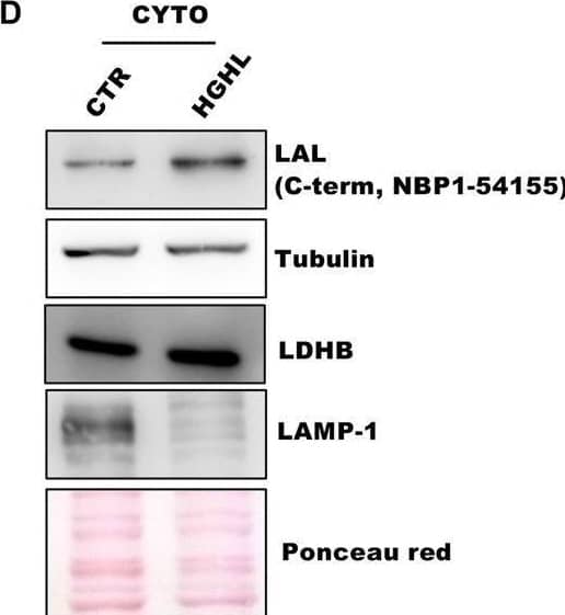 LAL protein accumulates in the extra-lysosomal compartment in an in vitro model of NAFLD.Huh7 cells were cultured in high-glucose/high-lipid (HGHL) medium for 8 days. A–C Analysis of LAL localization by confocal microscopy. The lysosomal marker LAMP1 (red) and total LAL protein (individuated by antibody against C-term) (green) were shown (A) and their abundance (B) and colocalization (C) were evaluated. Scale bar 25 μm. D, E Western blot analysis of LAL C-terminal domain, LDHB, Tubulin and LAMP-1 in in the cytosolic fraction (D) and evaluation of LAL content in the cytosolic fraction by calculating LAL to tubulin ratio through densitometric analysis (E). Representative images from one experiment out of three giving similar results are reported. Data are expressed as mean +/- SD (*p < 0.05, **p < 0.01 ***p < 0.001, vs CTR; n = 3). Image collected and cropped by CiteAb from the following open publication (//pubmed.ncbi.nlm.nih.gov/34795230), licensed under a CC-BY license. Not internally tested by Novus Biologicals.