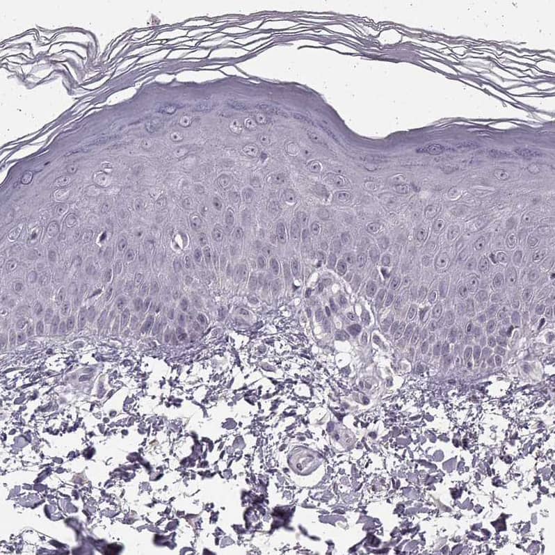 Staining of human skin shows no positivity in epidermal cells as expected.