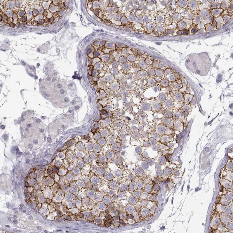 Staining of human testis shows strong membranous positivity in cells in seminiferous ducts.