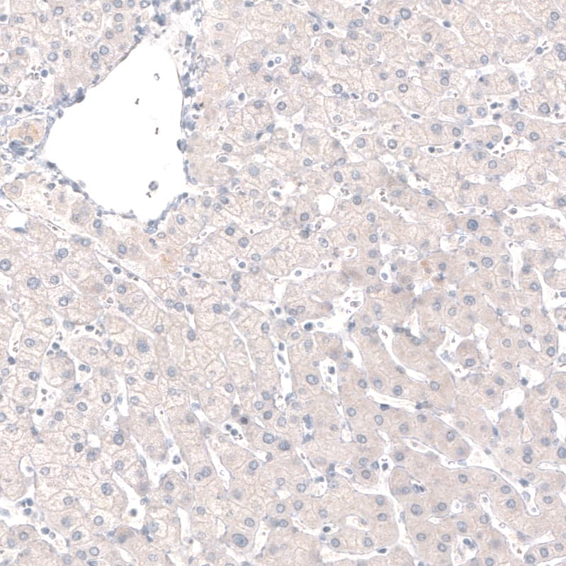 Staining of human liver shows no positivity in hepatocytes as expected.