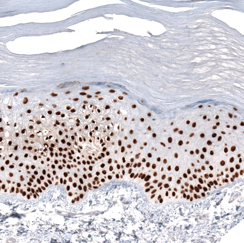 Staining of human skin shows strong nuclear positivity in squamous epithelial cells.
