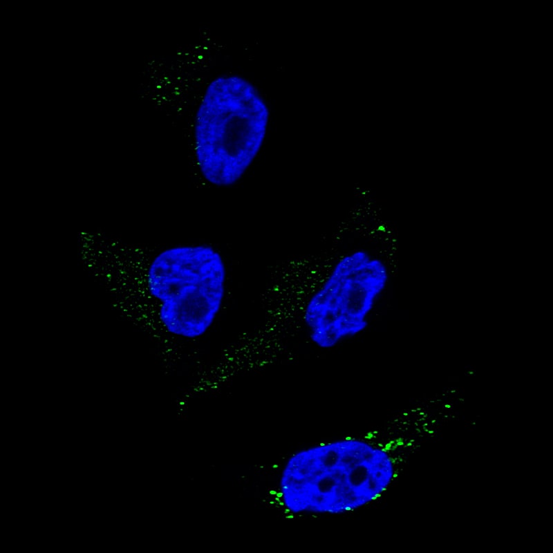 Staining of SK-MEL-30 cells, showing specific staining in the vesicles in green. Microtubule- and nuclear probes are visualized in red and blue, respectively (where available).