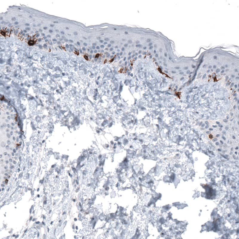 Staining of human skin shows strong cytoplasmic immunoreactivity in melanocytes.