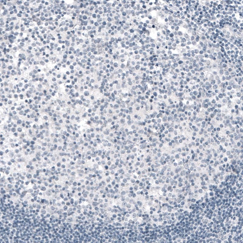 Staining of human tonsil shows no positivity in lymphoid cells as expected (negative control).