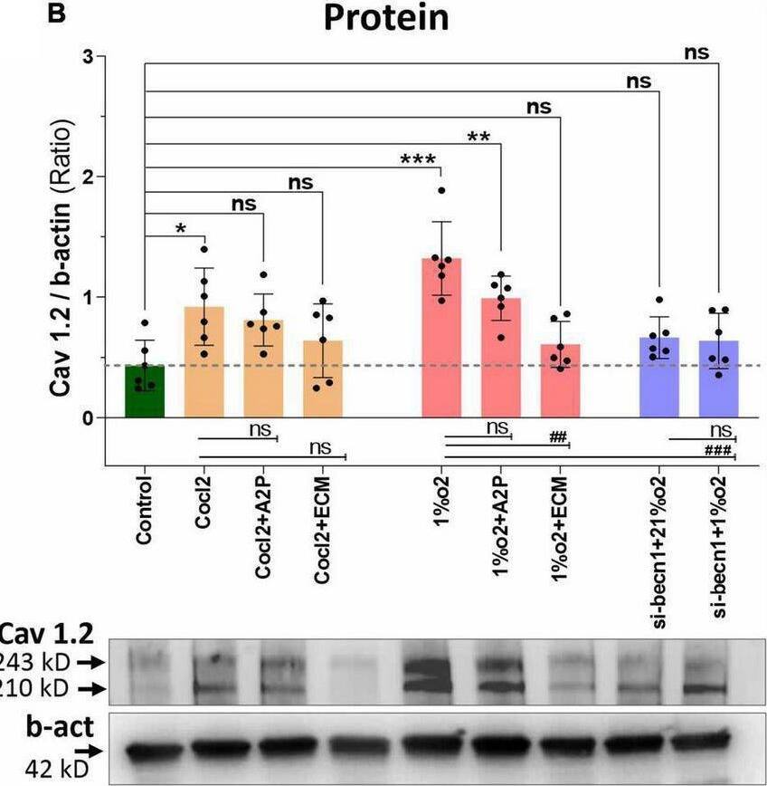 Hypoxia and Cocl2 exposure modifies the H9c2 cells Cav1.2 (CACNA1C) expression both at mRNA and protein level. (A) Cav1.2, mRNA expression levels, (B) Cav1.2 Protein expression levels and representative western blots. Compared to Controls Hypoxia increased the Cav1.2 expression at mRNA (****p < 0.0001) and Protein level (***p < 0.001). In addition, Cav1.2 mRNA levels are increased in Cocl2 + ECM (**p < 0.002) exposed cells. Compared to Hypoxia (1%O2), cells exposed to 1%O2 + A2P (####p < 0.0001), 1%O2 + ECM (####p < 0.0001) and in Beclin-1 inhibition cells grown under Hypoxia expressed significant decrease in Cav1.2 mRNA (####p < 0.0001) and Protein (###p < 0.001) expression levels. Data represents, n = 3 (mRNA) and n = 5 (Protein) independent samples/group. Bars are mean +/- S.D. Symbols *, +, #, and ≠ denotes significant, “ns